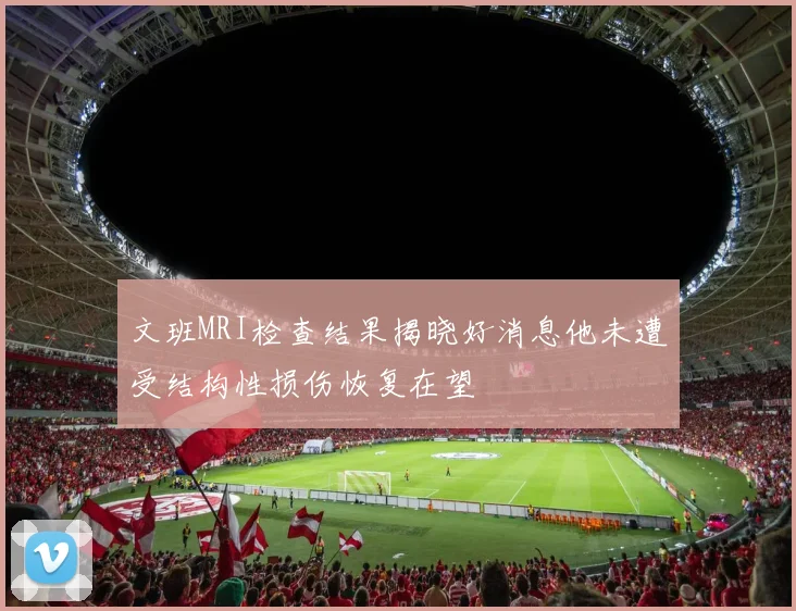 文班MRI检查结果揭晓好消息他未遭受结构性损伤恢复在望